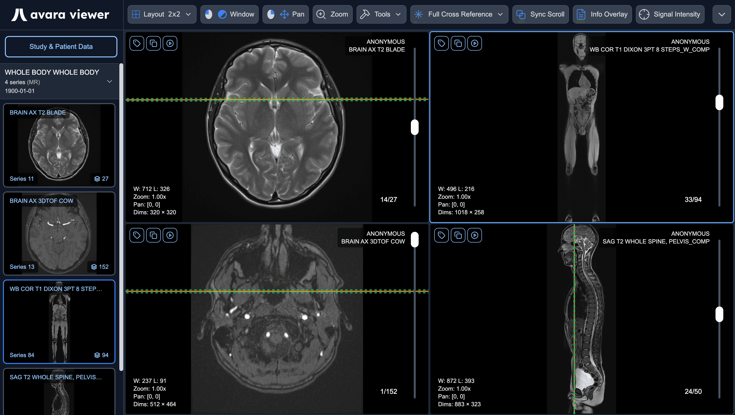 Avara Viewer Interface