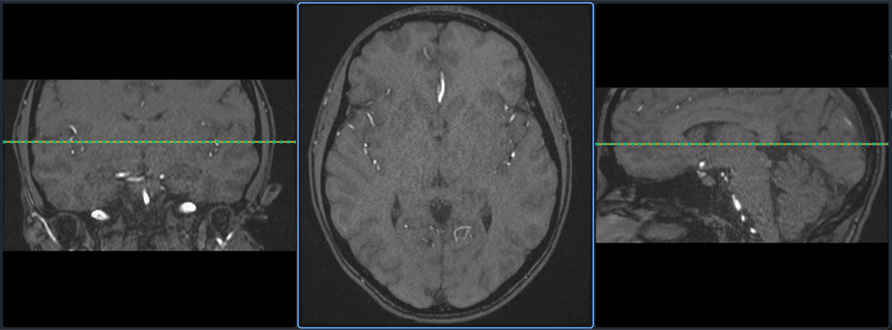 MPR projection tools