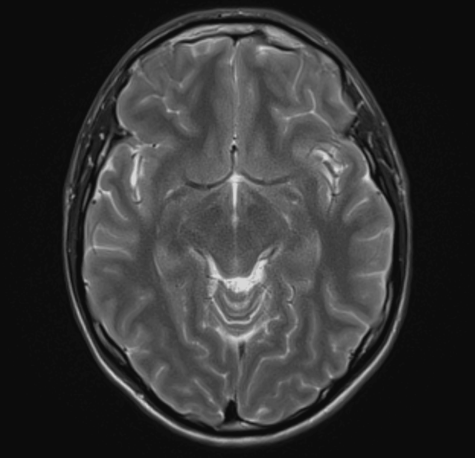 Shared imaging study