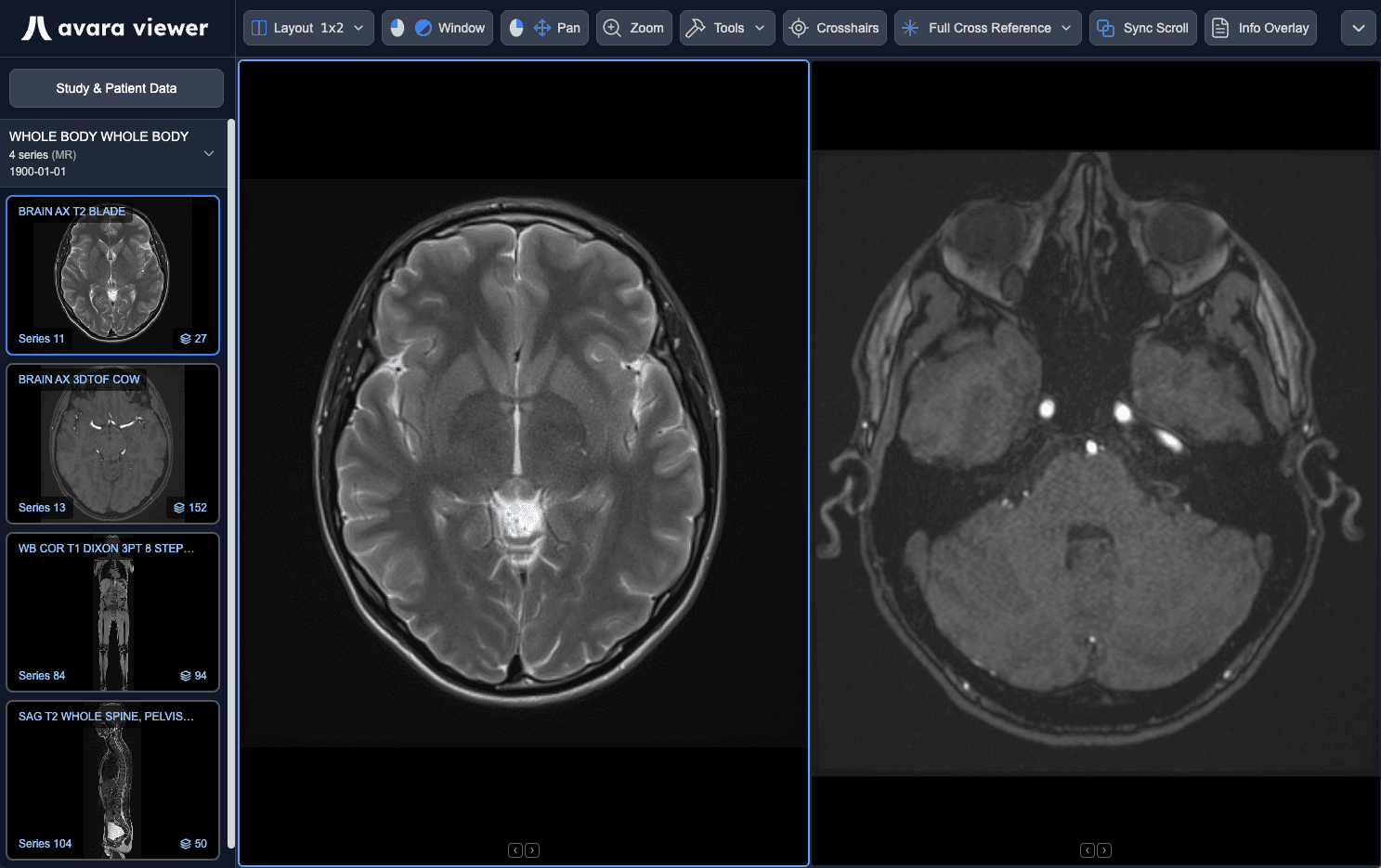 Avara Viewer diagnostic imaging workspace