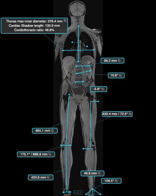 Specialty measurement tools