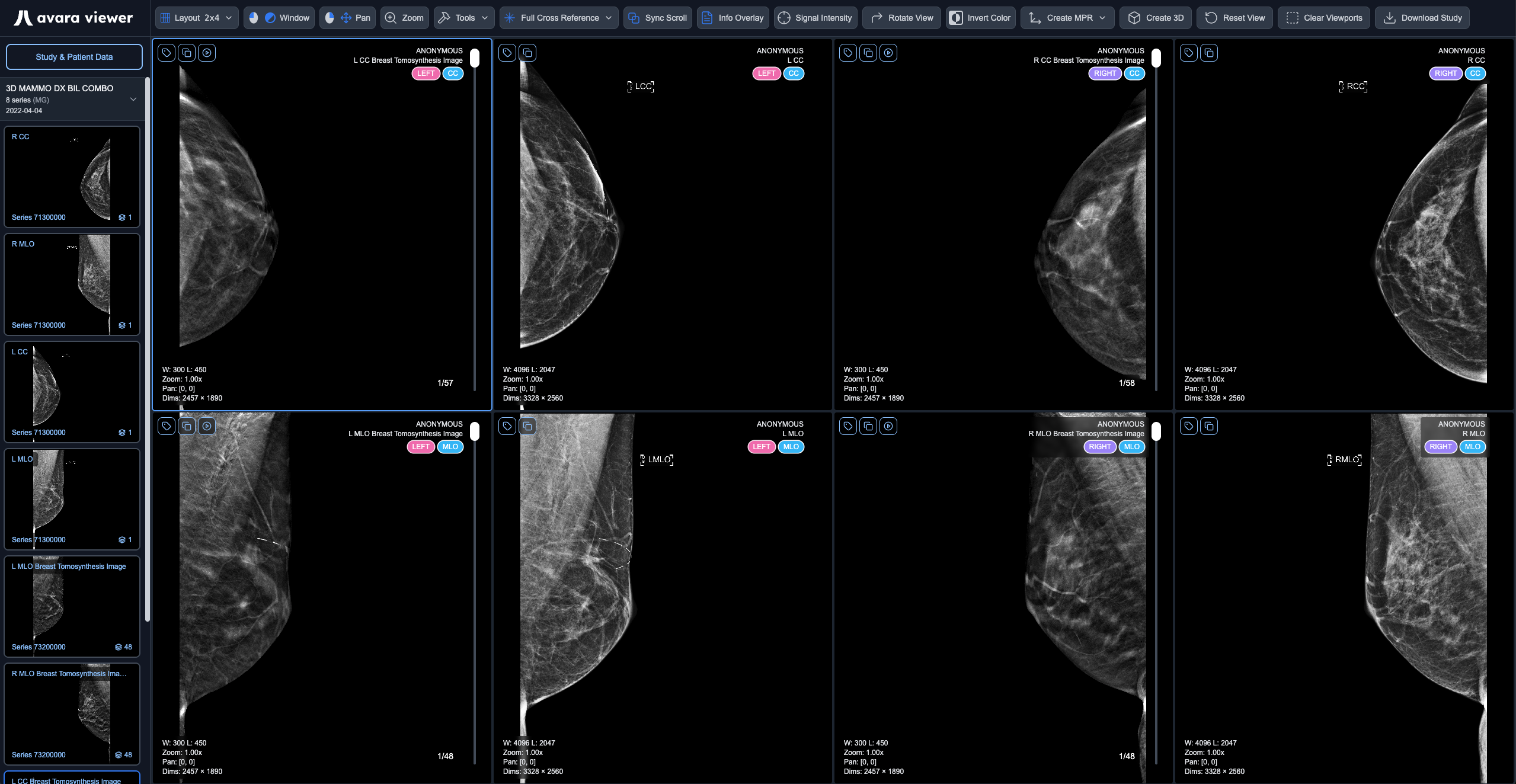 Mammography hanging protocol