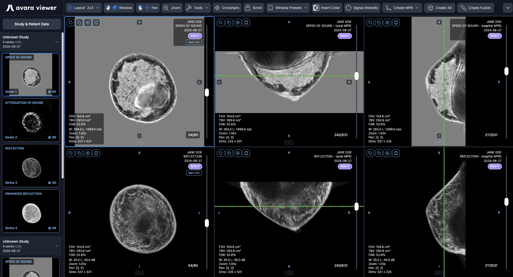QT Ultrasound hanging protocol