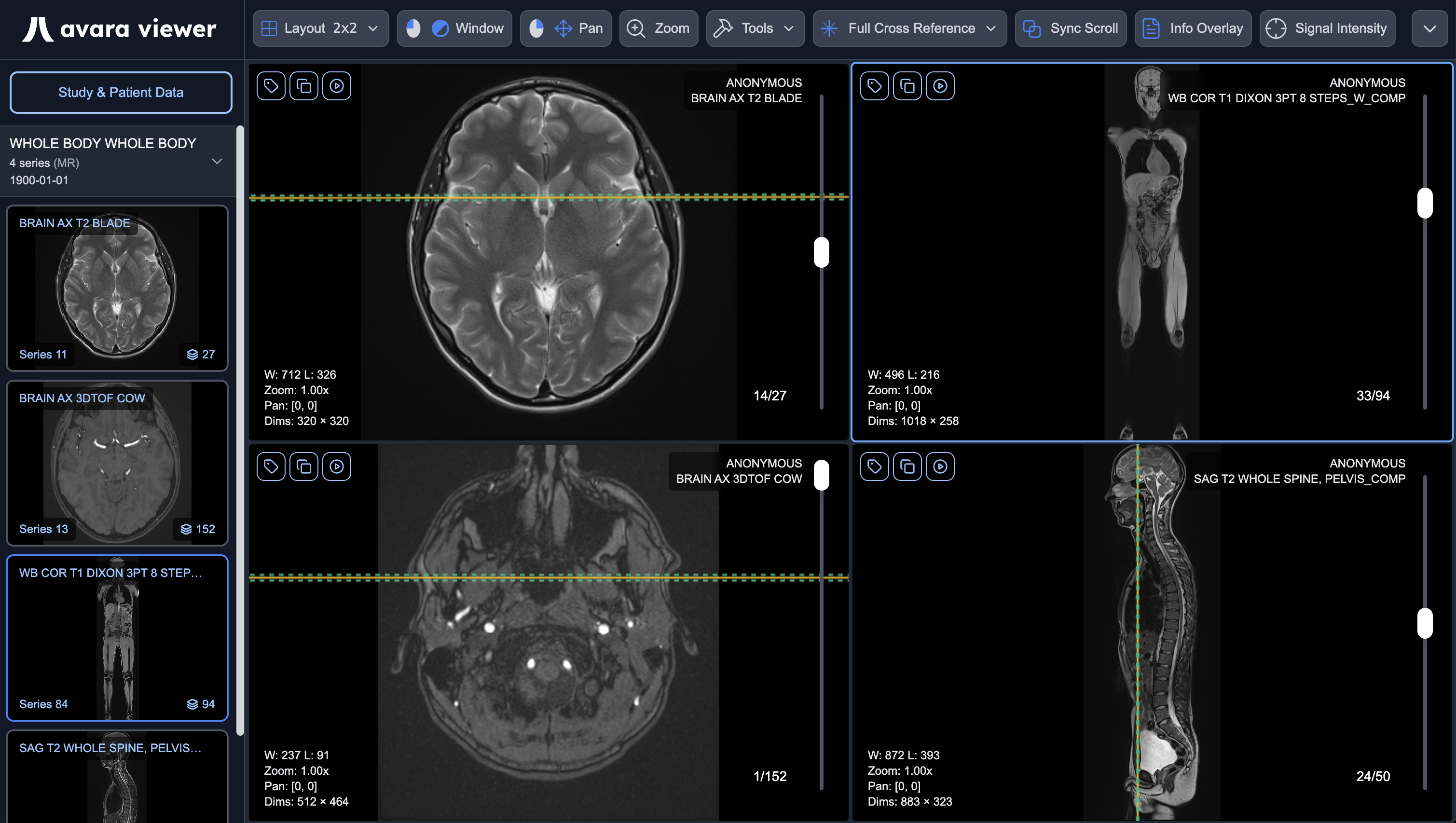 Avara Viewer - Web-based DICOM viewer interface
